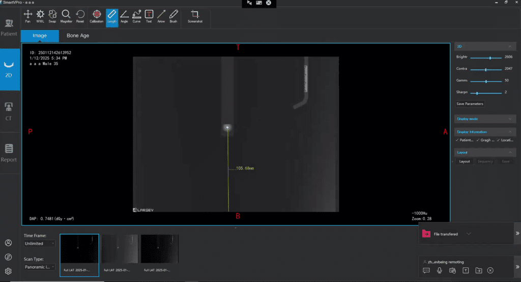 CBCT Installation in the Philippines - MeCanMed