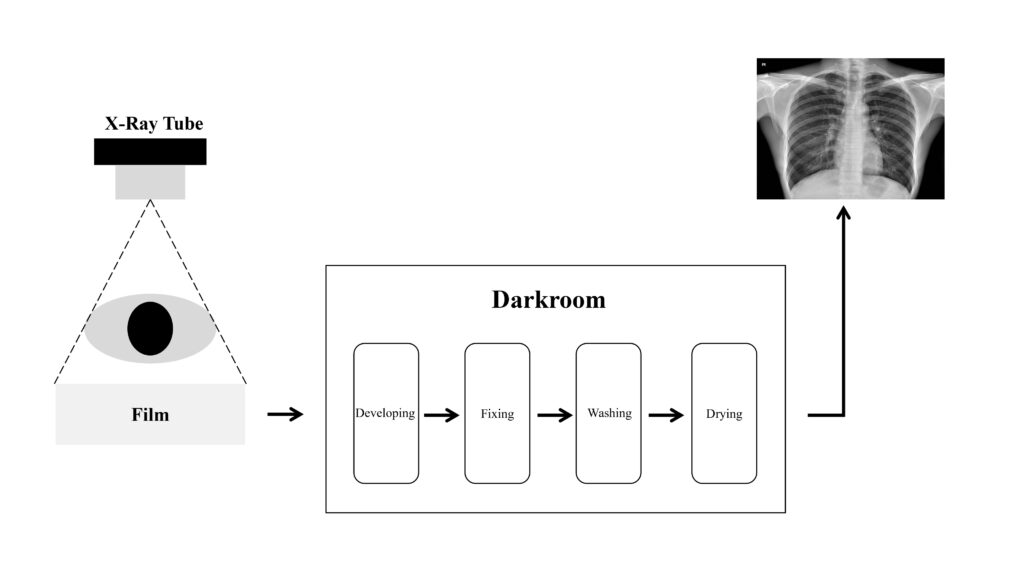 Workflow diagram of an analog film X-ray system showing chemical development process